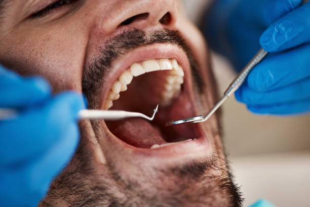Best Dentist for Tooth Abscess  in Kendallville, IN